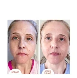 Dr Dennis Gross Alpha Beta Peel Extra Strength -Elemis Shop Alpha Beta Peel Extra Strength add2 50538 2858 general