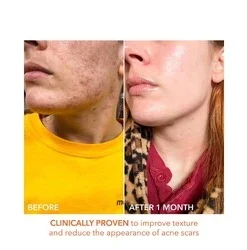 Dr Dennis Gross Alpha Beta Universal Daily Peel -Elemis Shop Alpha Beta Universal Daily Peel add3 55577 324 general