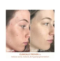 Dr Dennis Gross Alpha Beta Universal Daily Peel -Elemis Shop Alpha Beta Universal Daily Peel add5 55577 6334 general