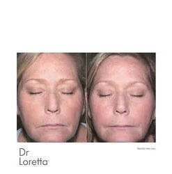 Dr Loretta Intense Brightening Cream -Elemis Shop Intense Brightening Cream add2 56314 1471 general