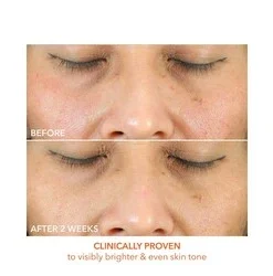 Dr Dennis Gross Vitamin C + Lactic Oil-Free Radiant Moisturizer 7 Dr Dennis Gross Vitamin C + Lactic Oil-Free Radiant Moisturizer -Elemis Shop Vitamin C Lactic Oil Free Radiant Mois 68794 6984 general